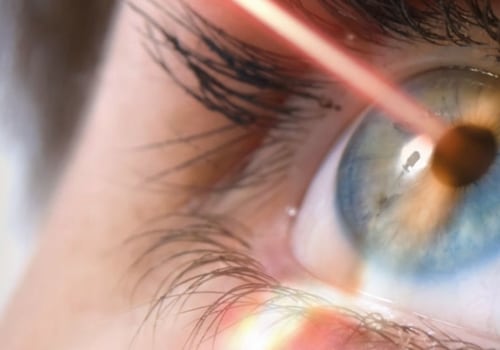The Advantages of Laser Eye Surgery